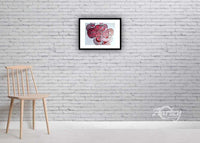 Post Traumatic Stress Disorder IV