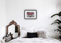 Somatoform Disorder III