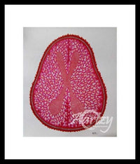 Schizophrenic Disorder