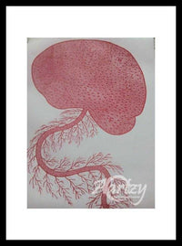 Somatoform Disorder II