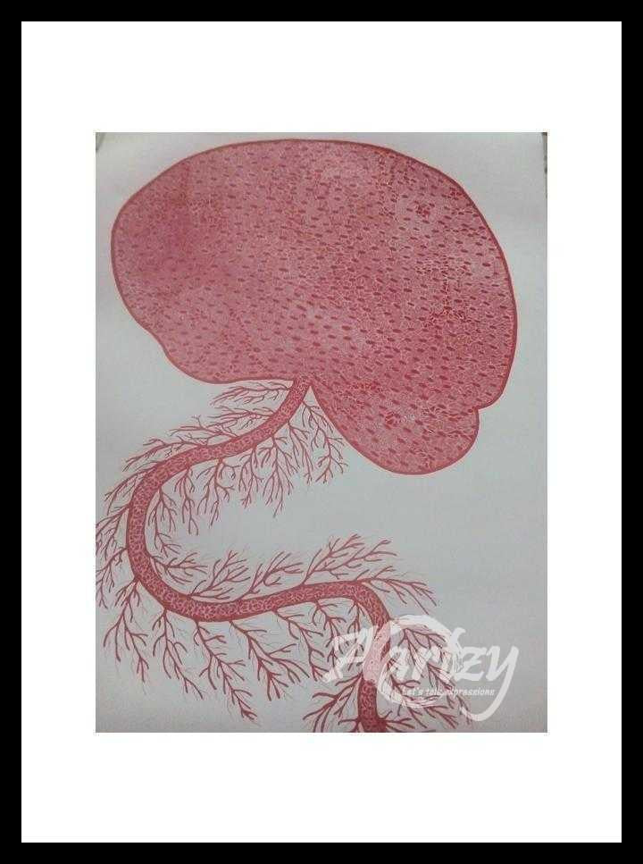 Somatoform Disorder II