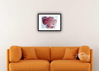 Post Traumatic Stress Disorder IV