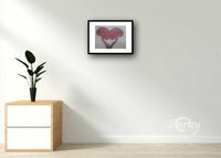 Somatoform Disorder III