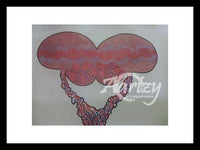 Somatoform Disorder III