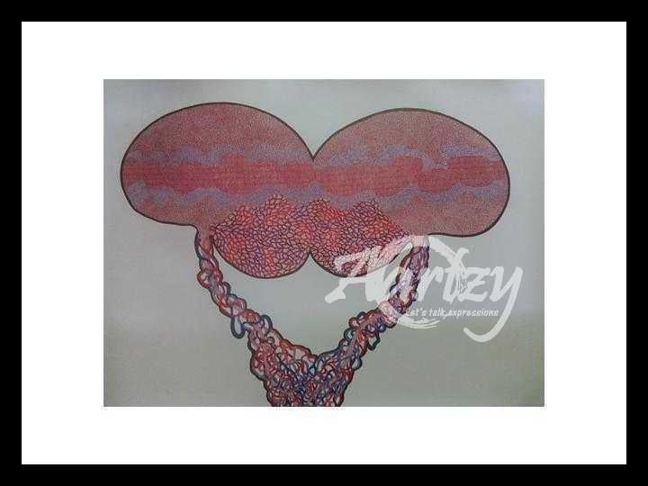 Somatoform Disorder III